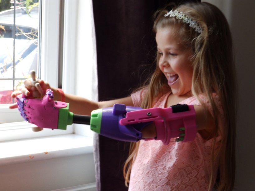 Amazing : Watch A Girl Named Isabella Unpack a New 3-D Printed Arm